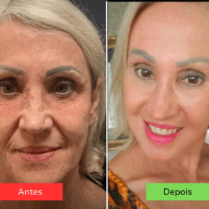 Antes-1-1.png